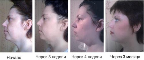 Мудрые статусы со смыслом про любовь и жизнь Лансопразол: инструкция по применению, цена, аналоги и отзывы