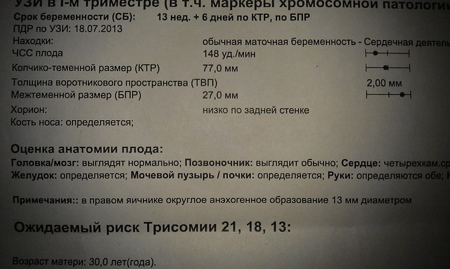 Расшифровка при беременности. Что такое ИАЖ на УЗИ при беременности. ОАА при беременности расшифровка. Инвитро УЗИ при беременности. УЗИ скрининг инвитро.