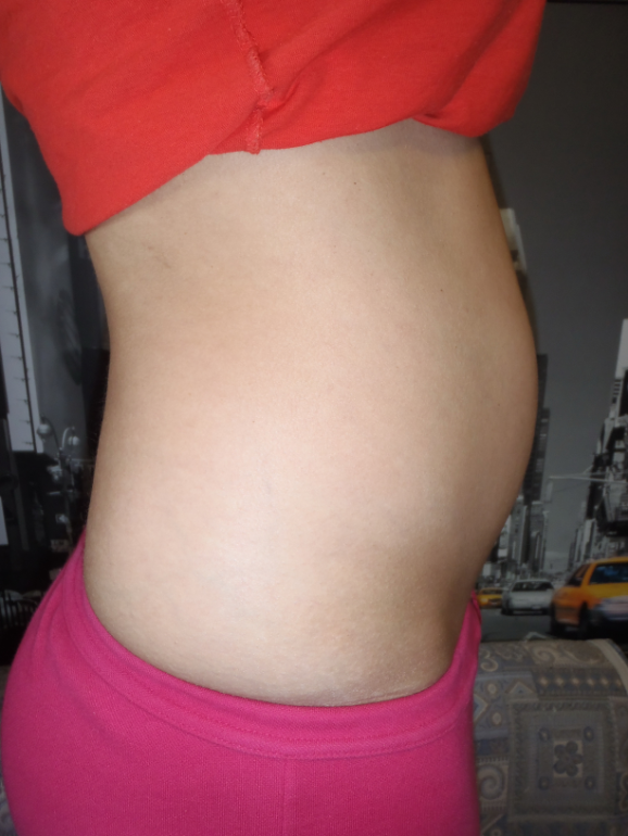 Как выглядит животик на 12 неделе беременности фото