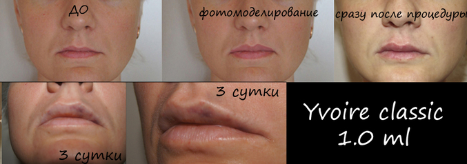 fa68657bc4d83ec9fe1546505e9a9349.jpg