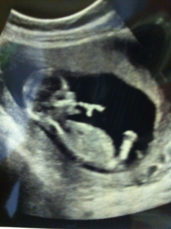 Фото ребенка 13 недель. УЗИ плода на 14 неделе беременности. УЗИ 13-14 недель беременности. УЗИ 14 недель беременности.