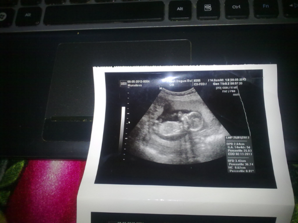 8 месяцев беременности фото узи