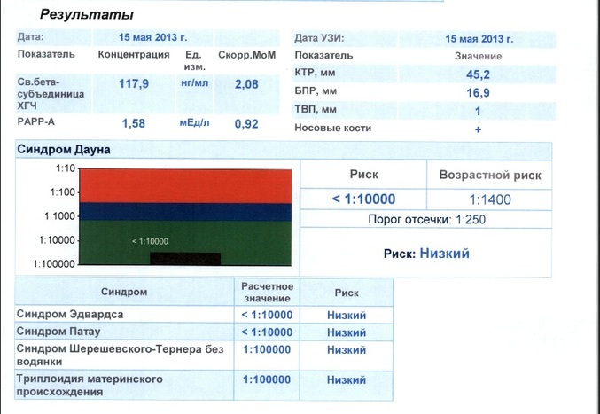 Скрининг 1 триместра фото плода