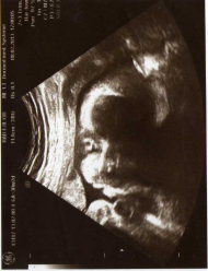 Фото УЗИ на 30 неделе беременности