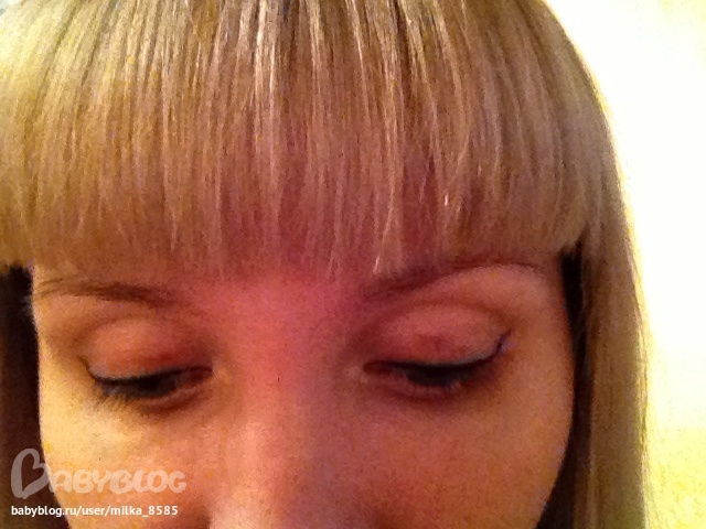 Верхнее веко день пятый