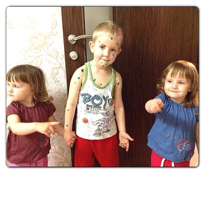 Ветрянка, наш опыт.