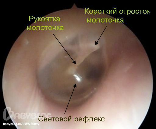 Разработка барабанного вакуум-фильтра