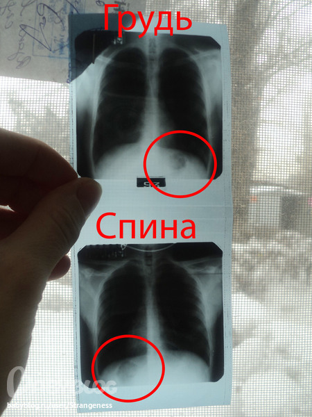 Болят легкие. | форум Babyblog