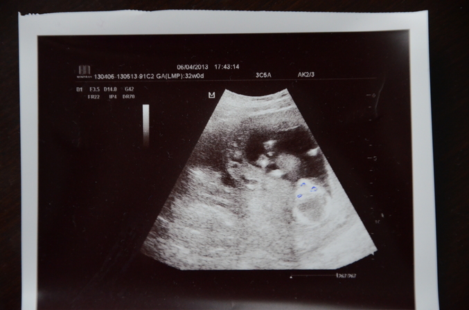 Сколько будет через 20 недель. Как выглядит плод во 2 триместре. Ребёнок на 20 неделе беременности. Сколько будет через 20 недель. Сколько будет через 20 недель.