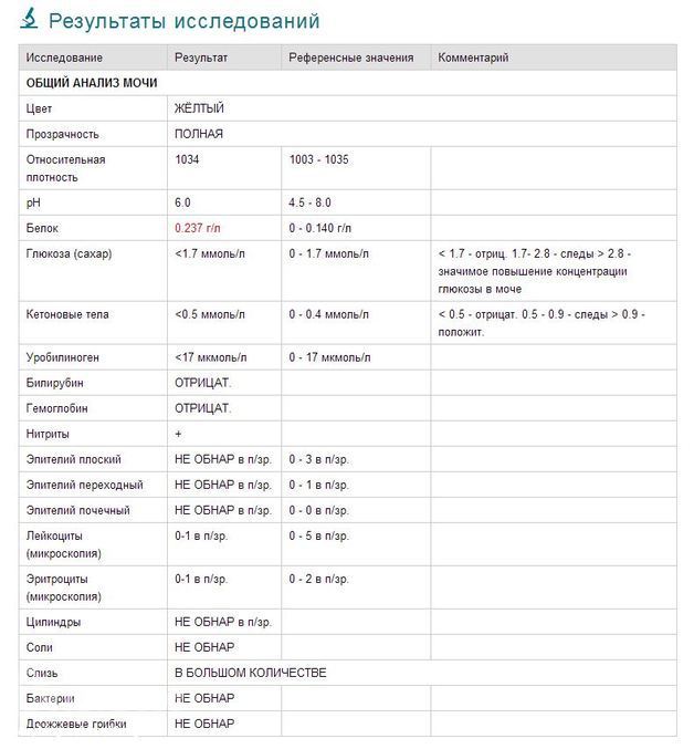 Расшифровка анализа мочи таблица